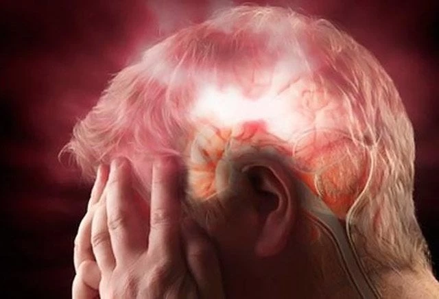 Δείτε ποια αναψυκτικά αυξάνουν τον κίνδυνο εγκεφαλικού επεισοδίου!